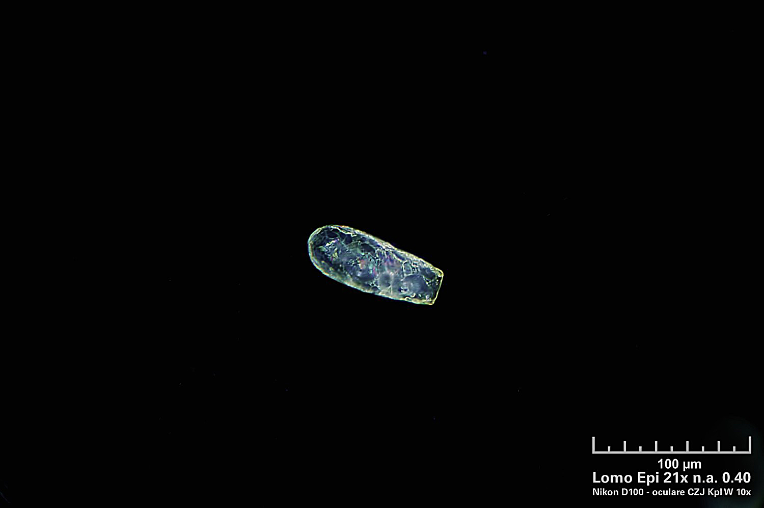 Tecameba in episcopia